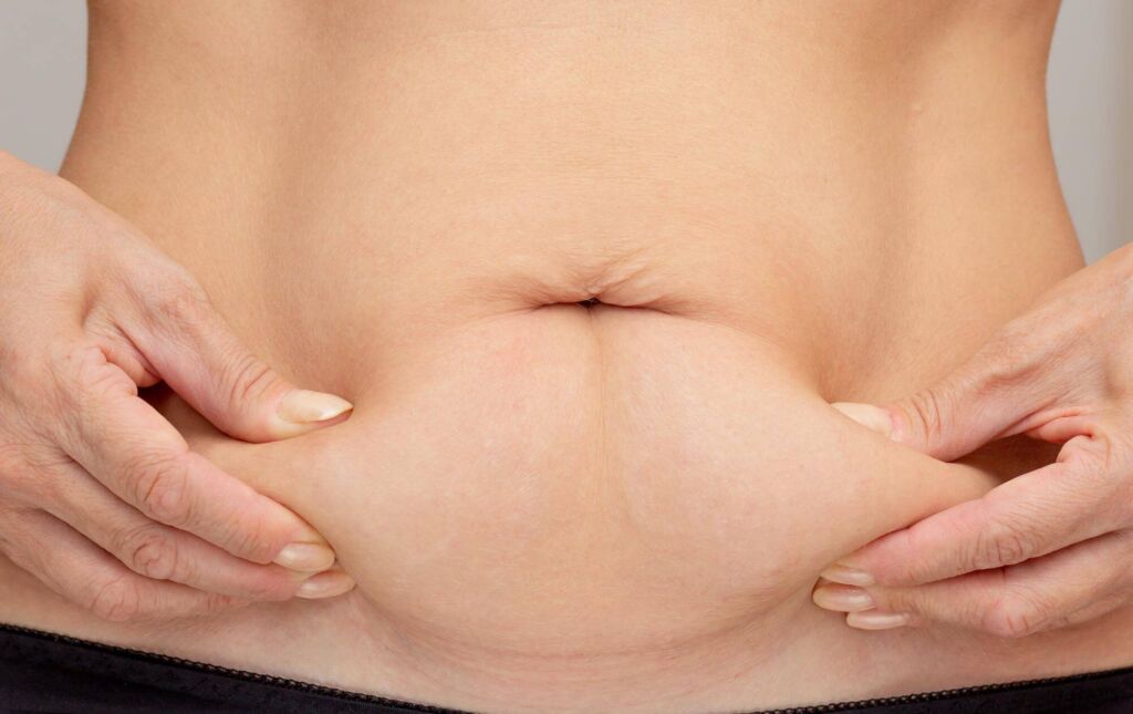 hängender bauch nach schwangerschaft